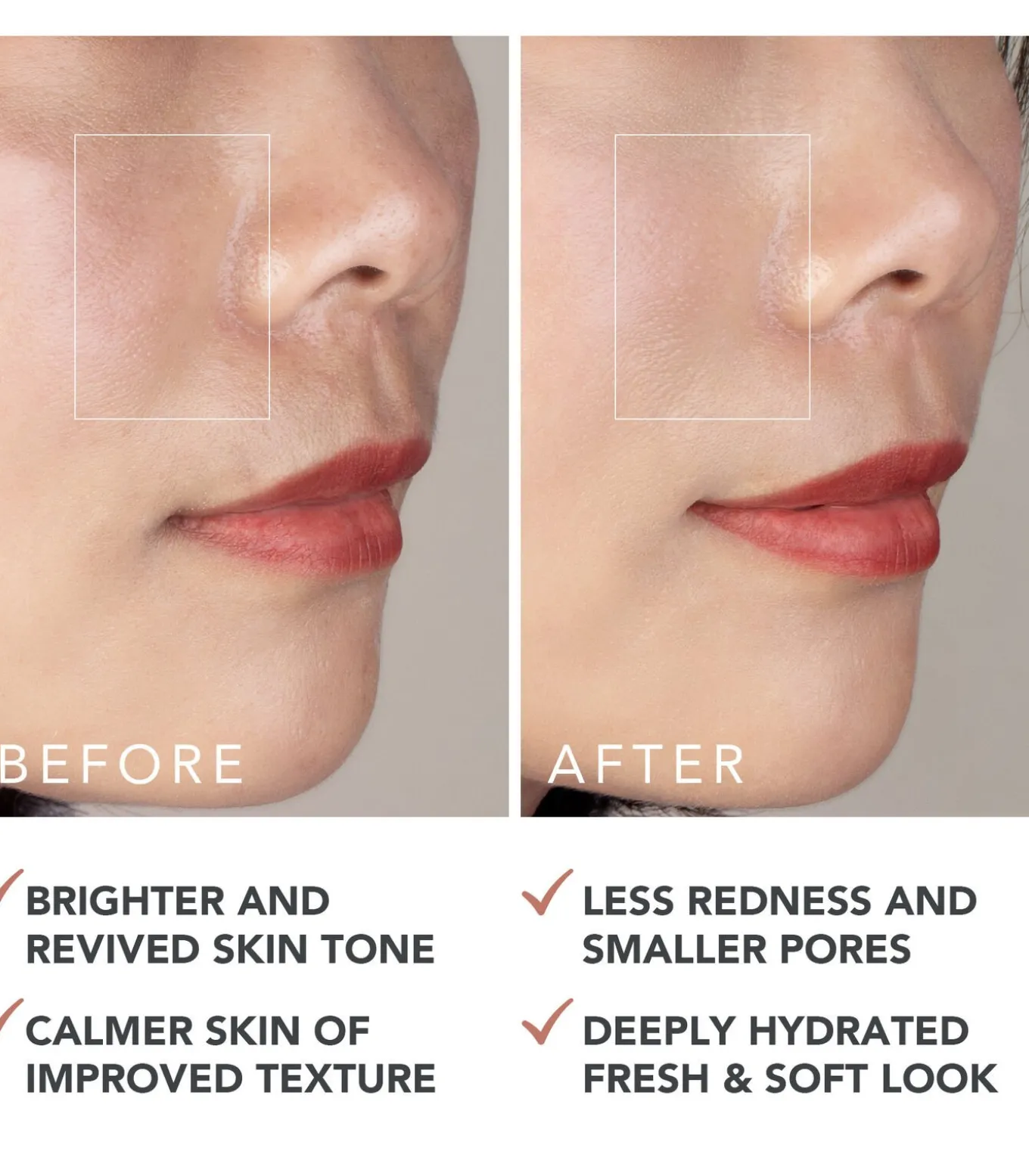 FOREO SUPERCHARGED™ Barrier Restoring Essence Mist